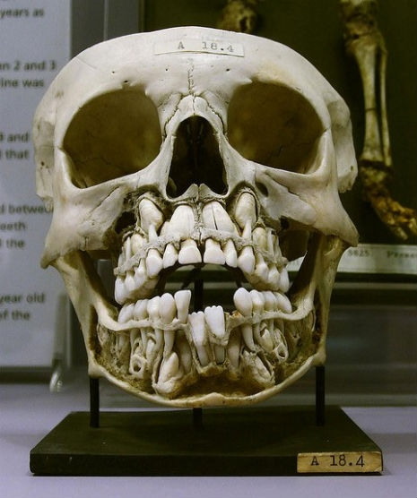 image.png.1c75e3dbe1dcc03eee014826ccabcc82.png