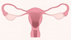 Fibromul uterin - cele mai eficiente metode de tratament