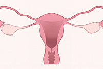 Fibromul uterin - cele mai eficiente metode de tratament