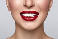 3 mituri comune despre implantul dentar