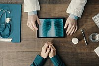 Cancer pulmonar: 6 lucruri pe care trebuie sa le stii despre aceasta boala