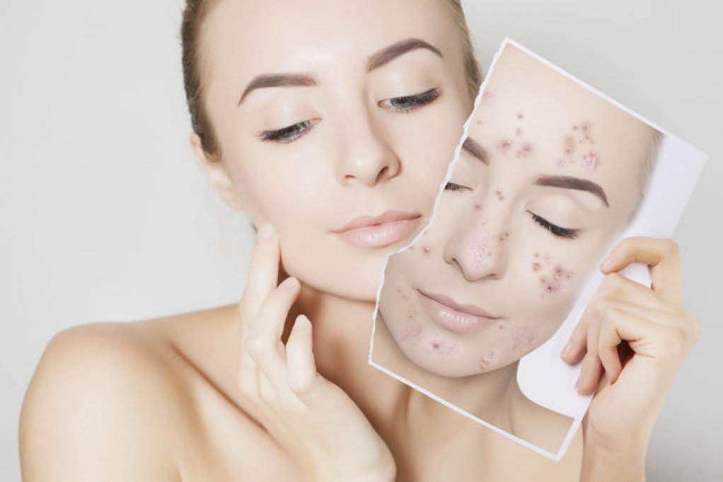 3 pasi simpli pentru un ten perfect