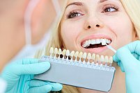 Avantajele fațetelor dentare. 10 motive să alegi această procedură