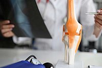 Ce trebuie să știi despre proteza de genunchi