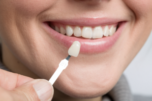 Coroane și fațete dentare: care este diferența dintre ele și cum ar trebui să alegi?