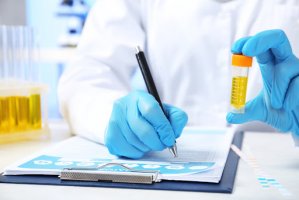 Examenul de urină: 5 situații în care e recomandat