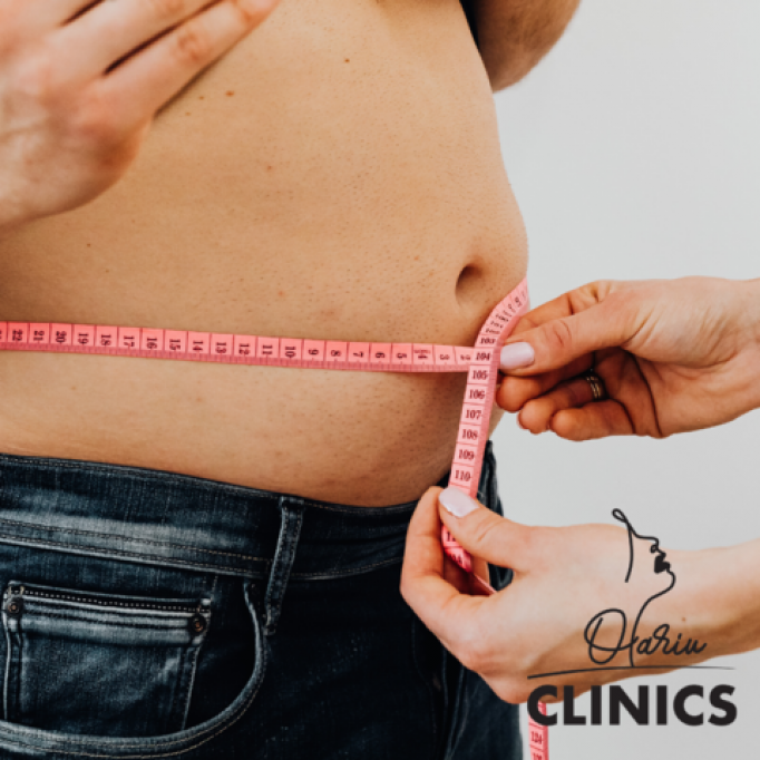 Ce trebuie să știi despre intervenția chirurgicală de liposuctie abdominala