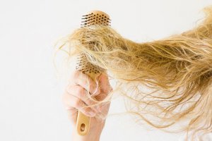 Patopsihologia alopeciei androgenice