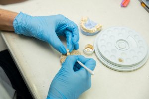 Cum te ajuta vizionarea testimonialelor sa scapi de emotiile de dinaintea tratamentului cu implant dentar?