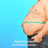 Solutia pentru transformarea zonei abdominale