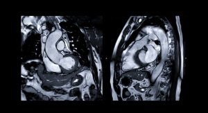Coronarografia vs. Rezonanta magnetica (RMN): care sunt diferențele?