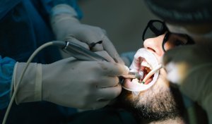  Beneficiile unui implant dentar
