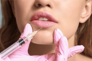 Tratamente cu acid hialuronic: obține buzele la care ai visat mereu