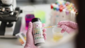 Top 7 afecțiuni care pot fi depistate printr-un singur control de rutina al analizelor de urină și fecale