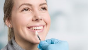 Ce sunt fațetele dentare și când sunt recomandate?