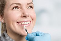 Ce sunt fațetele dentare și când sunt recomandate?