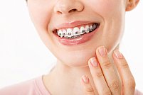 De ce este importantă identificarea și tratarea problemelor ortodontice indiferent de vârstă?