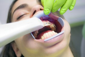 Tratamentul ortodontic la copii: de ce este important să acționezi devreme?