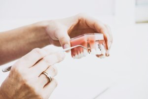 Cat dureaza un implant dentar?