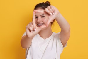 3 lucruri de știut după tratamentul cu aparat dentar